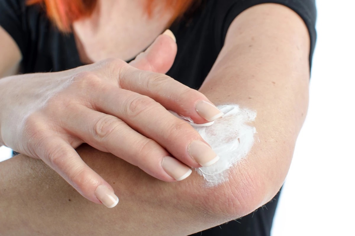 ChemoCreamSkin
